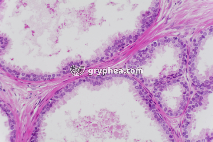 Prostate x100 - gryphea.com